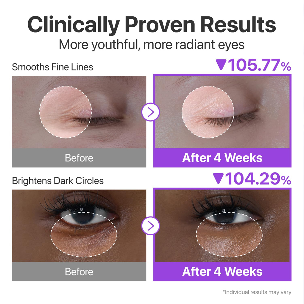 Korean Electric Eye Cream Nad+ Retinal Peptides Niacinamide Brightening Dark Circles Lightening Eye Gel Anti-Wrinkle Formula