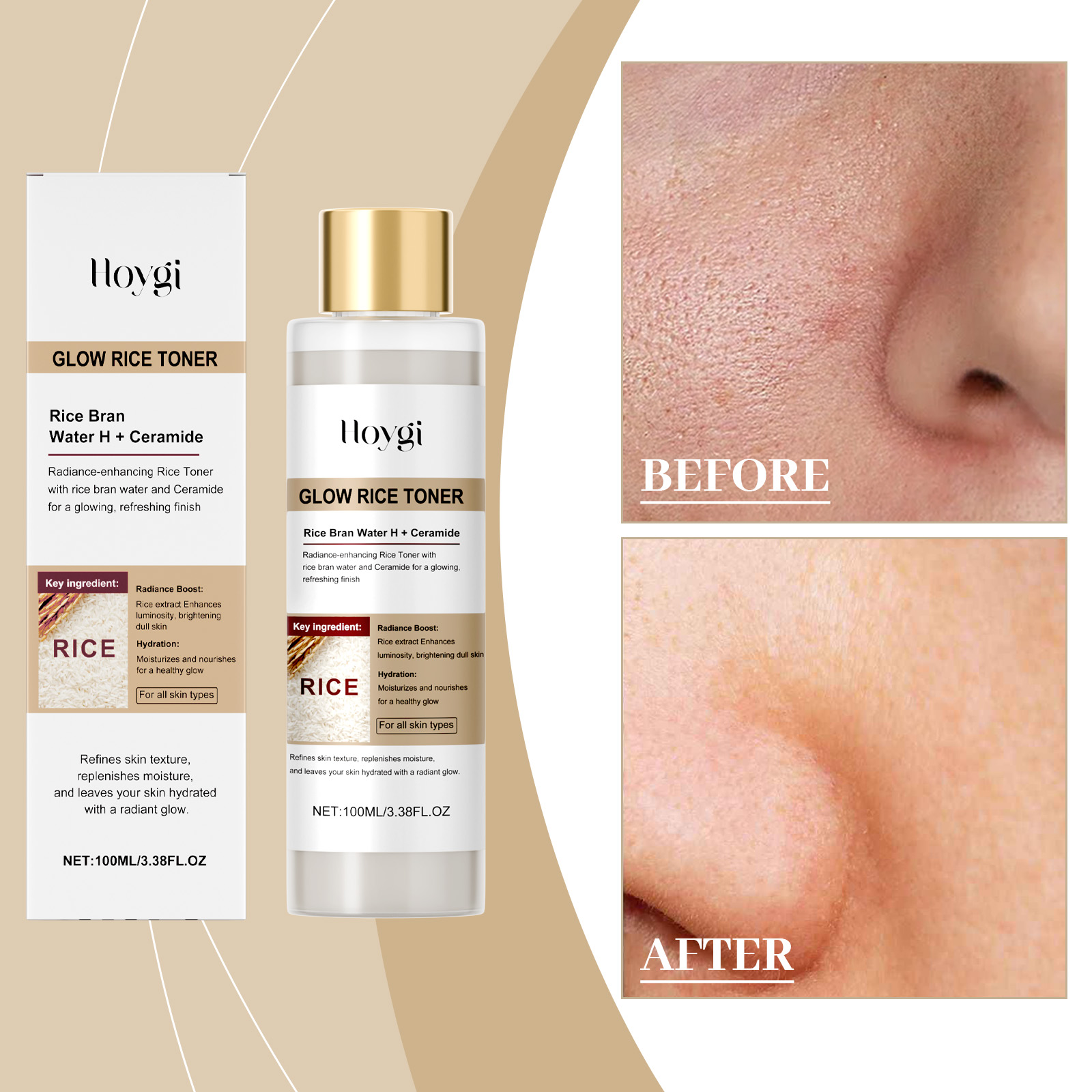 Hoygi Rice Moisturizing Brightening Soothing Repairing Essence Skincare Toner