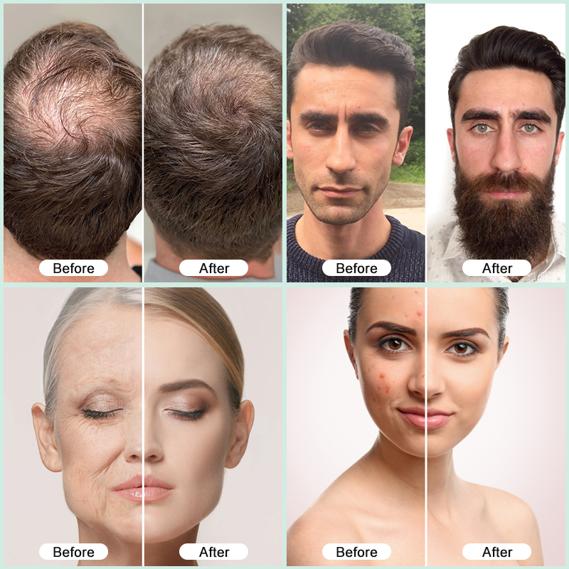 Skin Care Serum Formulation