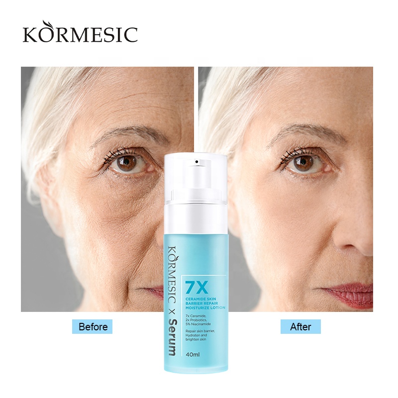 Private Label KORMESIC 7X Ceramide Skin Barrier Repair Moisturize Lotion Serum