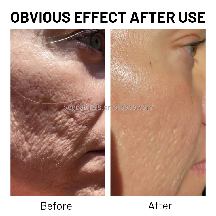Skin Types Moisturizer