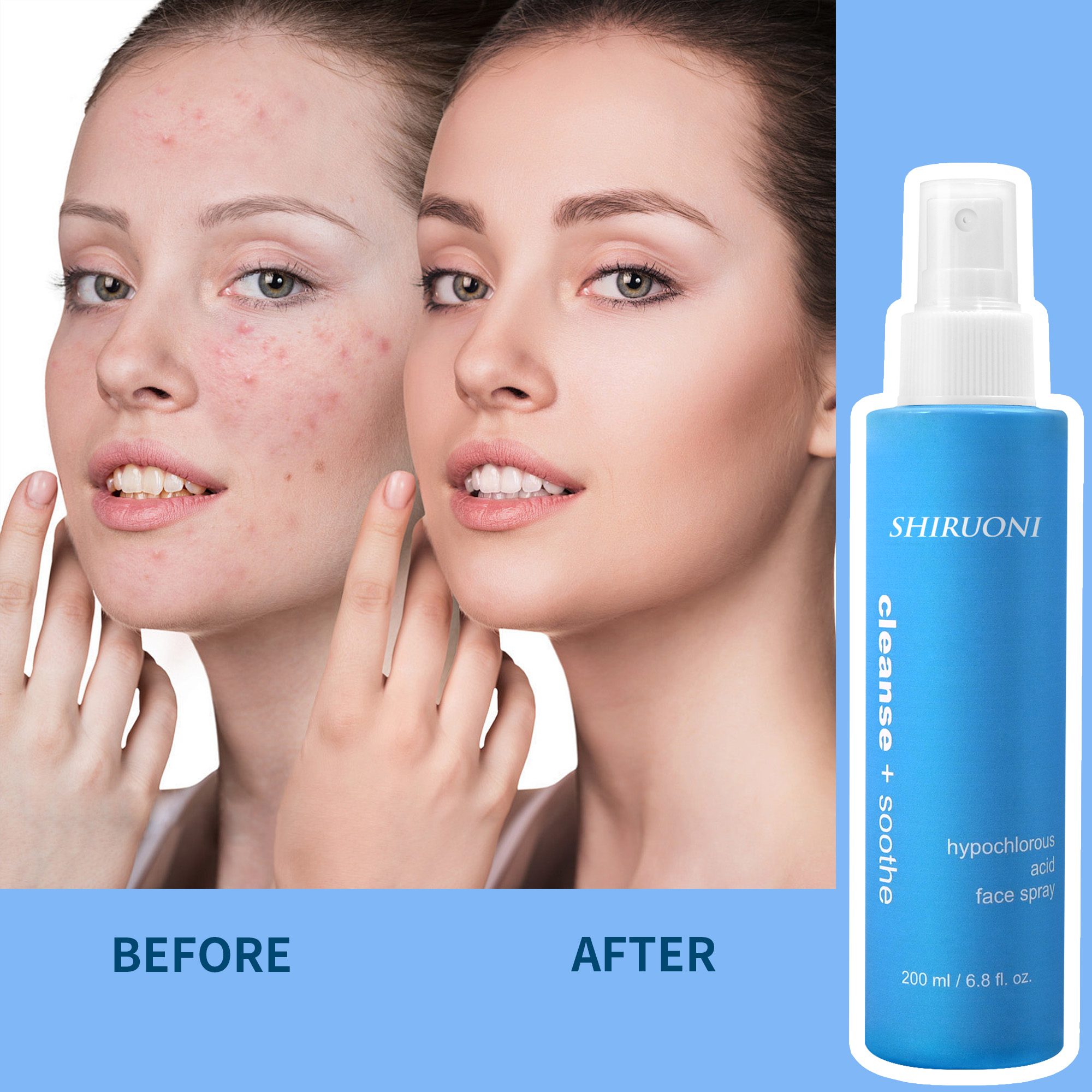 Private Label Organic Mist Hypochlorous Acid Daily Facial Spray Hydrating Calming Repairing Face Skincare Water Toner