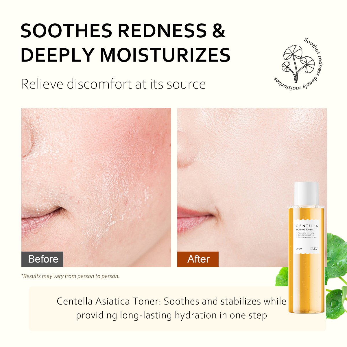Private Label Centella Asiatica Toner Soothing Redness Repairing The Skin Barrier Refreshing Smooth And Moisturizing OEM Toner