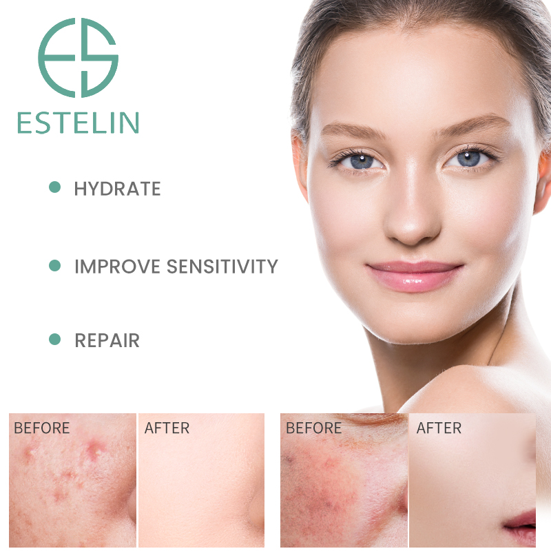 ESTELIN Bulk 30ml Ceramide B5 Moisturizing Repairing Face Serum Custom Private Label Serum