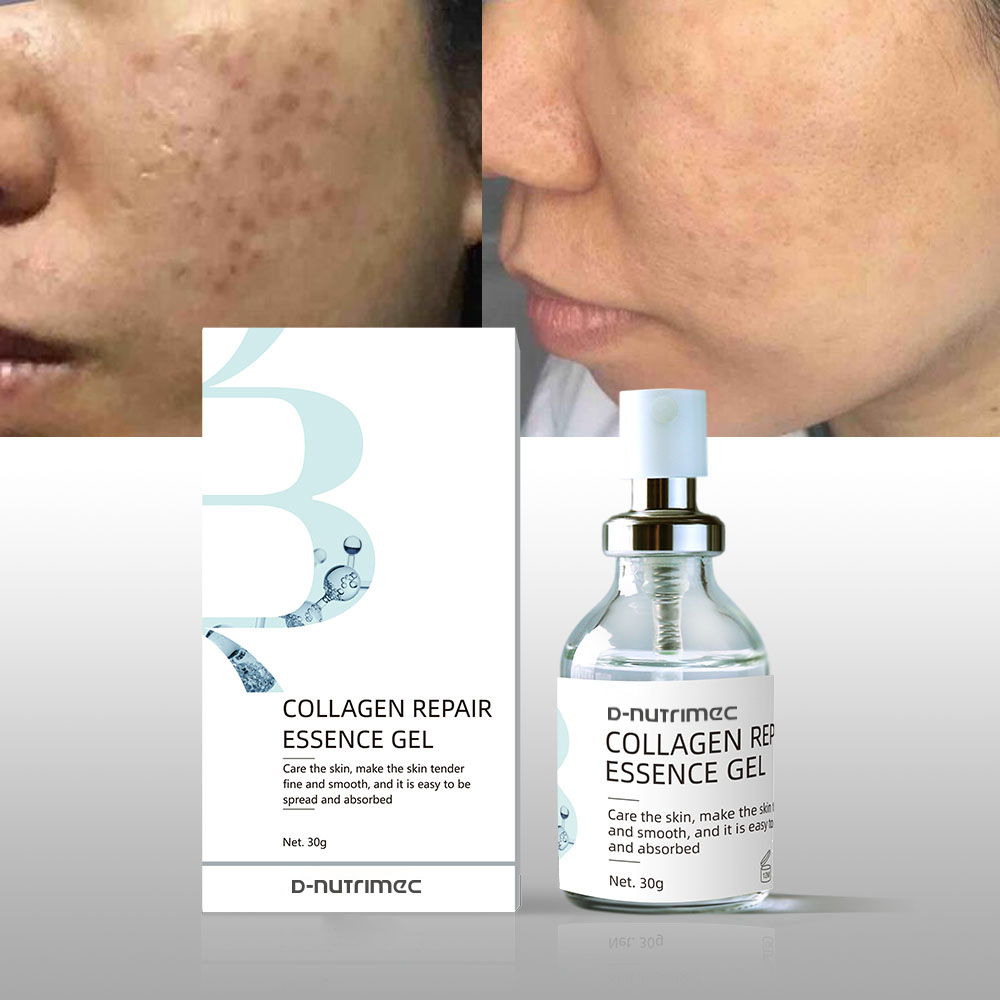 Sensitive Redness Relief Humanized Collagen Repair Gel Collagen Protein Serum Collagen Peptides Face Serum