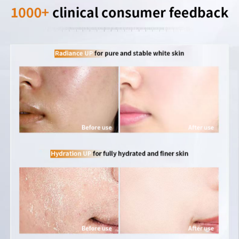OEM Flash Sale Ceramide NP Facial Nourishing Oil Skin Smoothing and Calming Barrier Repair Serum Oil for Face for Skin Repair