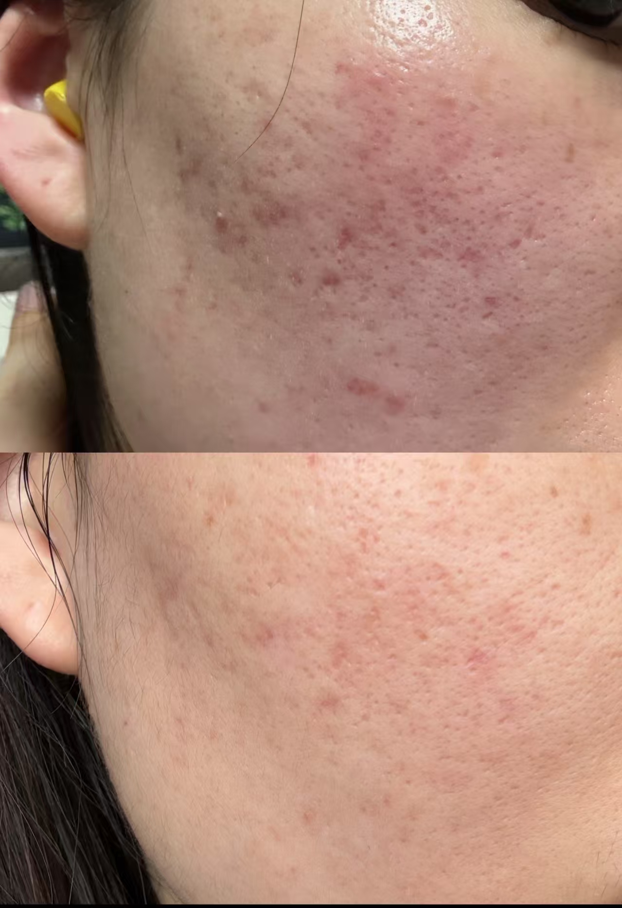 OEM Flash Sale Ceramide NP Facial Nourishing Oil Skin Smoothing and Calming Barrier Repair Serum Oil for Face for Skin Repair