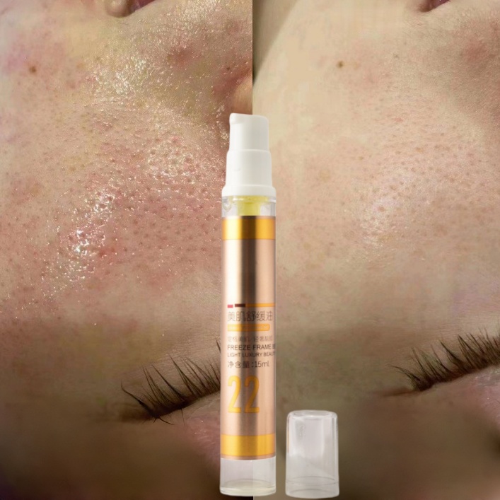 OEM Flash Sale Ceramide NP Facial Nourishing Oil Skin Smoothing and Calming Barrier Repair Serum Oil for Face for Skin Repair