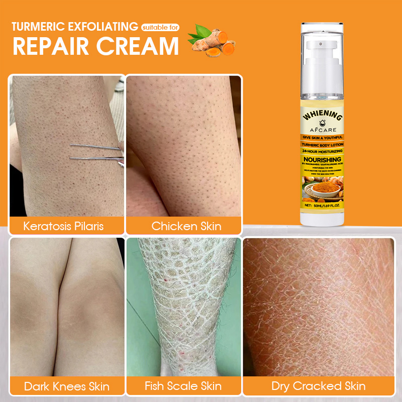 Turmeric Body Lotion24-Hour Moisturizing 8% Niacinamide 5%Hyaluronic Acid