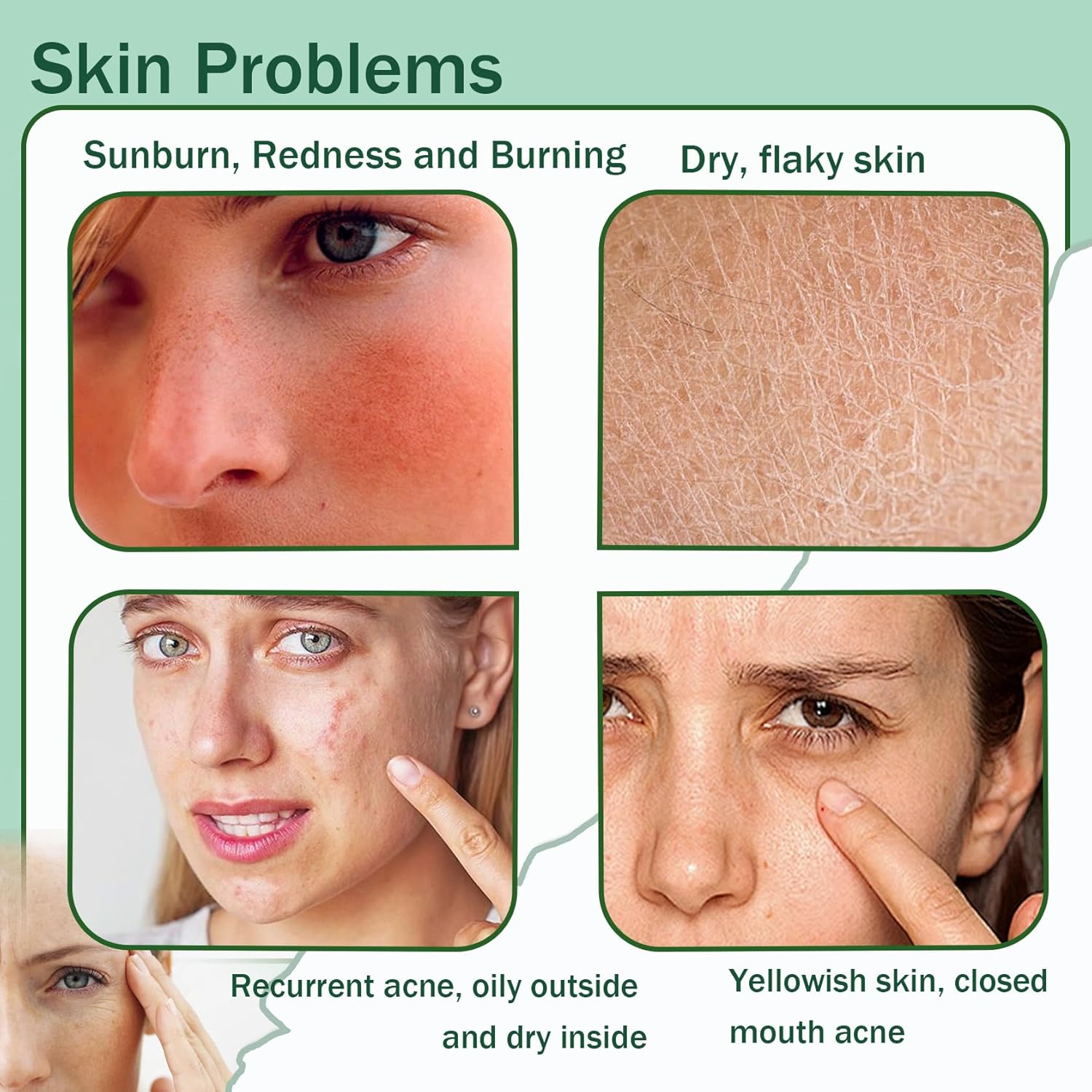 Sadoer Collagen Gel 300g Hydrating Moisturizing Nourishing Refreshing Face Massage Unisex
