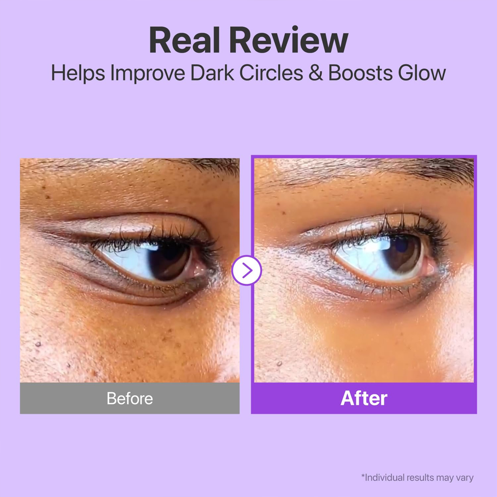 Korean Electric Eye Cream Nad+ Retinal Peptides Niacinamide Brightening Dark Circles Lightening Eye Gel Anti-Wrinkle Formula