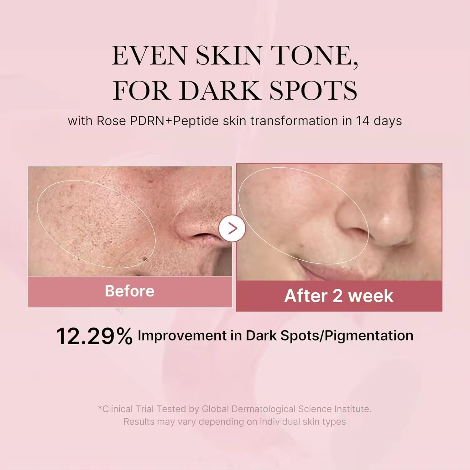 Wholesale Medicub Pink Repair Soothing Water Toner 250ml Light Refreshing Not Oily Plump and Radiant