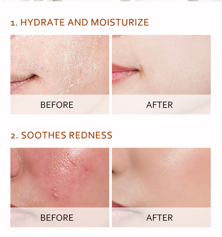 Centella Asiatica Toner Detail 9