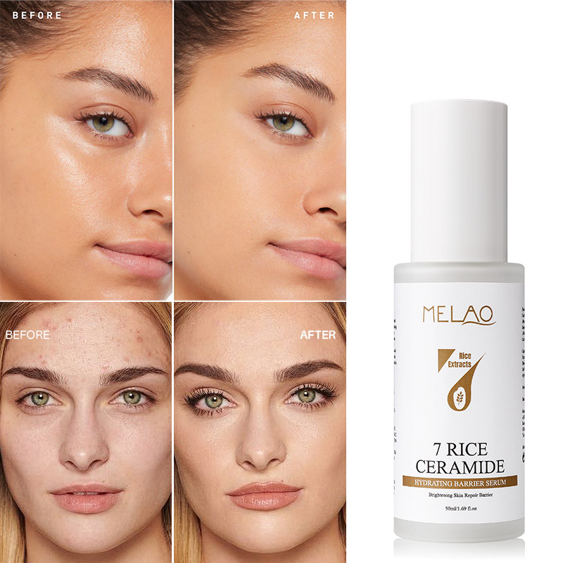 Korean Skin Care Even Skin Tone Repair Oil Control Brightening Hydrating Rice Ceramide Barrier Serum