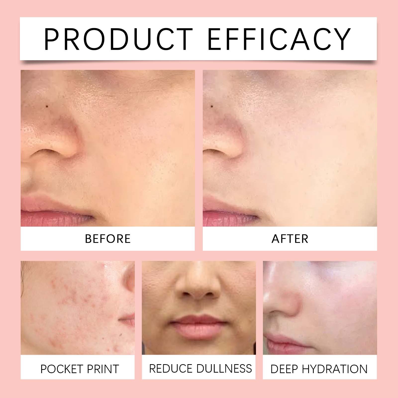 Hoygi Organic Natural Herbal Extract Serum Mist Soothing Repairing Anti-dryness Hydrating Rose Water Facial Toner Spray