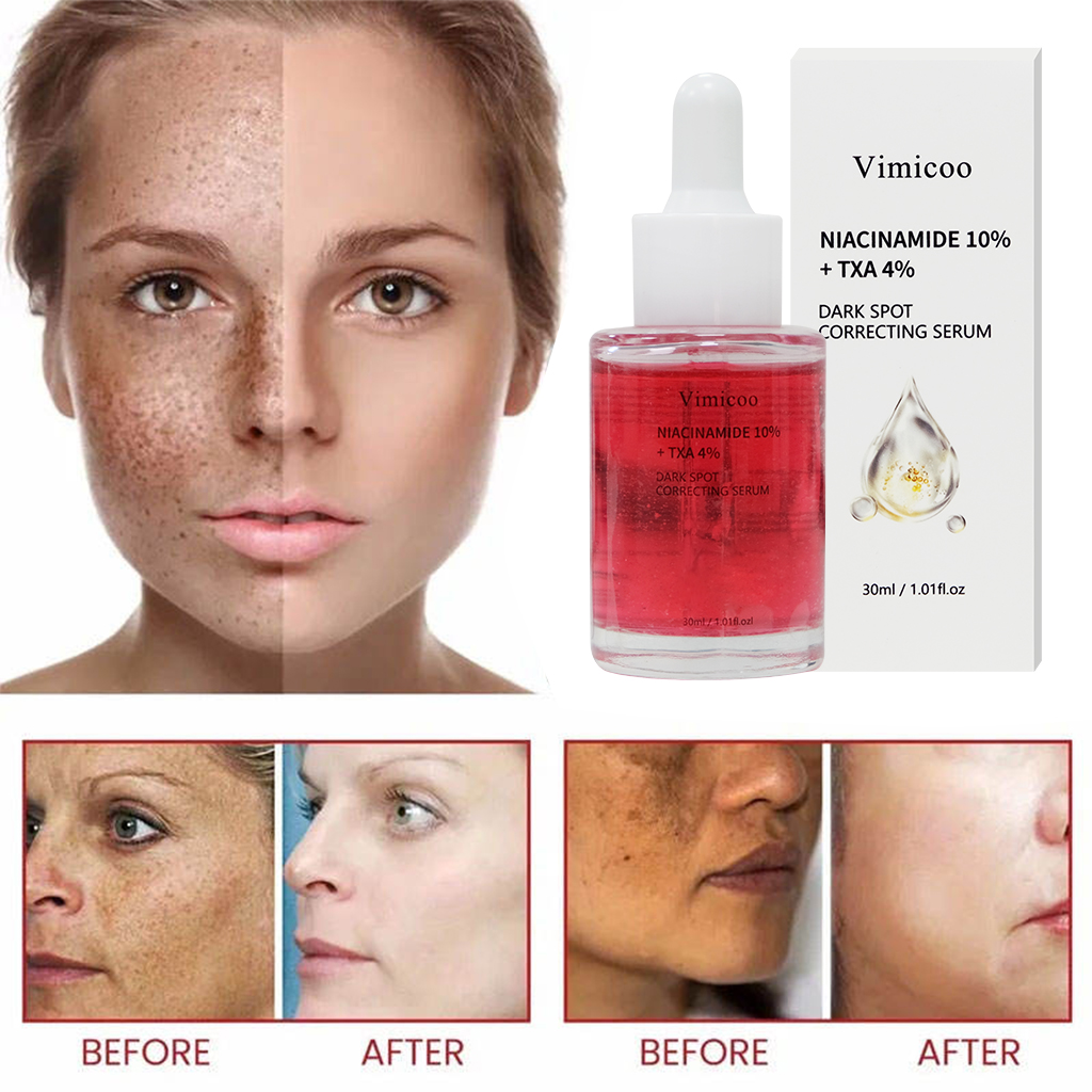 Private Label Dark Spot Remover Face Serum Niacinamide 10% Tranexamic Acid 4% Pigmentation Correctors Stains Remover Essence
