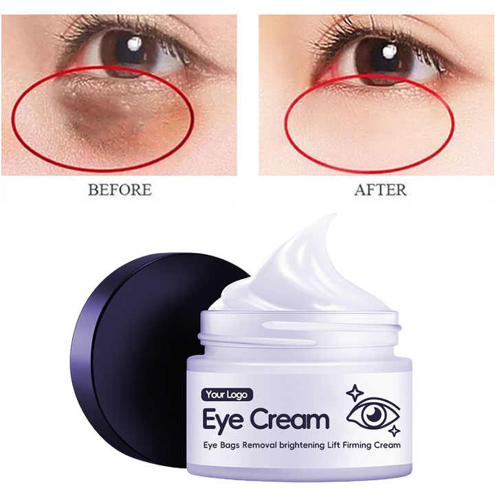 Retinol Firming Eye Cream Aloe Vera Mildly Moisturizing Nourishing Remove Eye Lines Dark Circles