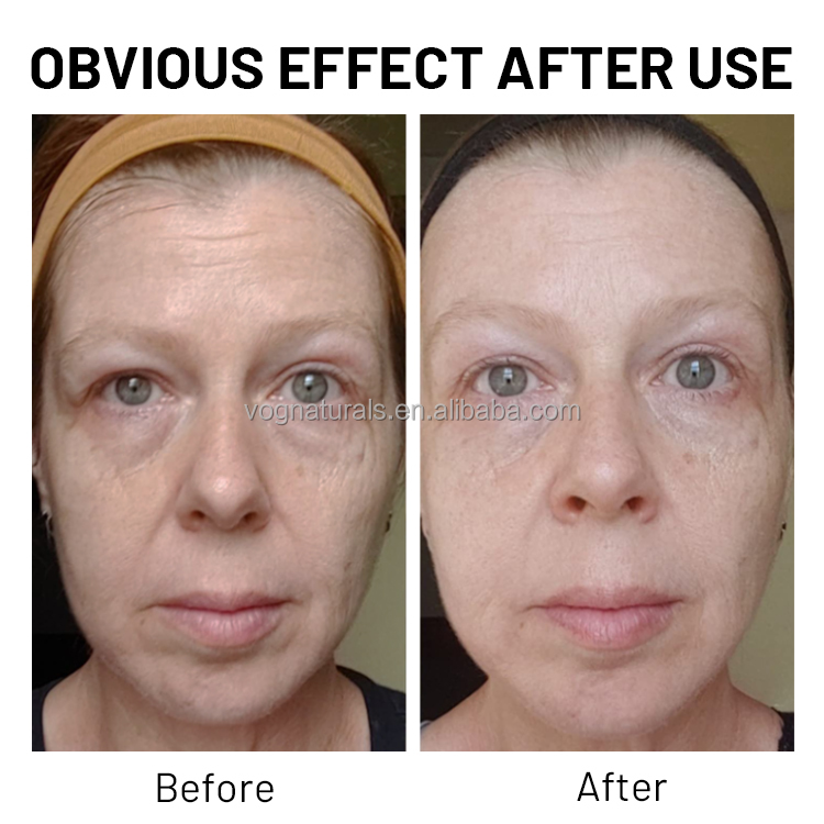 Polyglutamic Acid Serum
