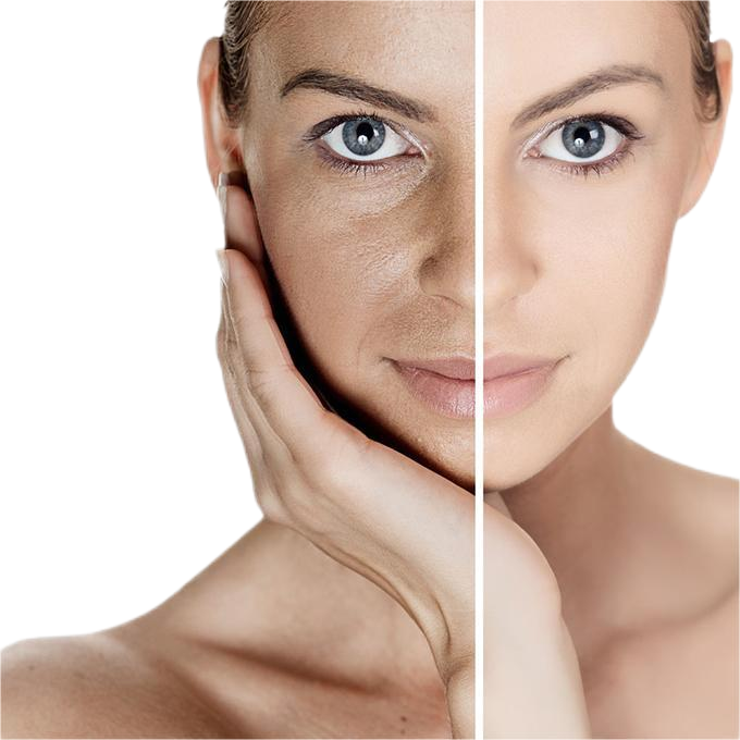 Ceramide Complex Showcase