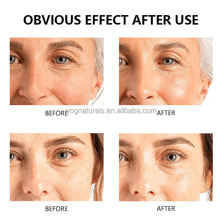 Pro-Collagen Gel
