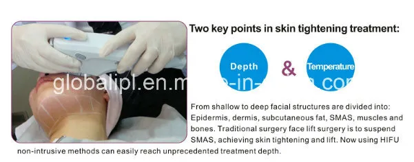 Hifu skin stimulation process