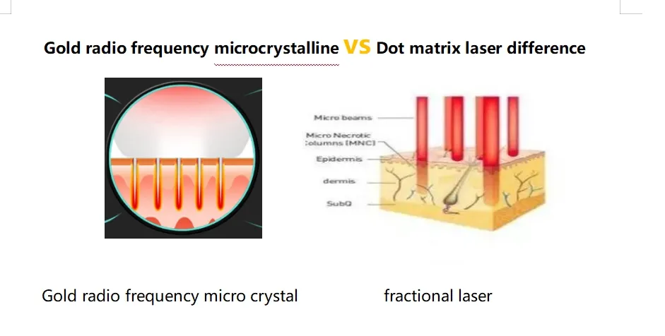 Advanced Plasma Beauty Device