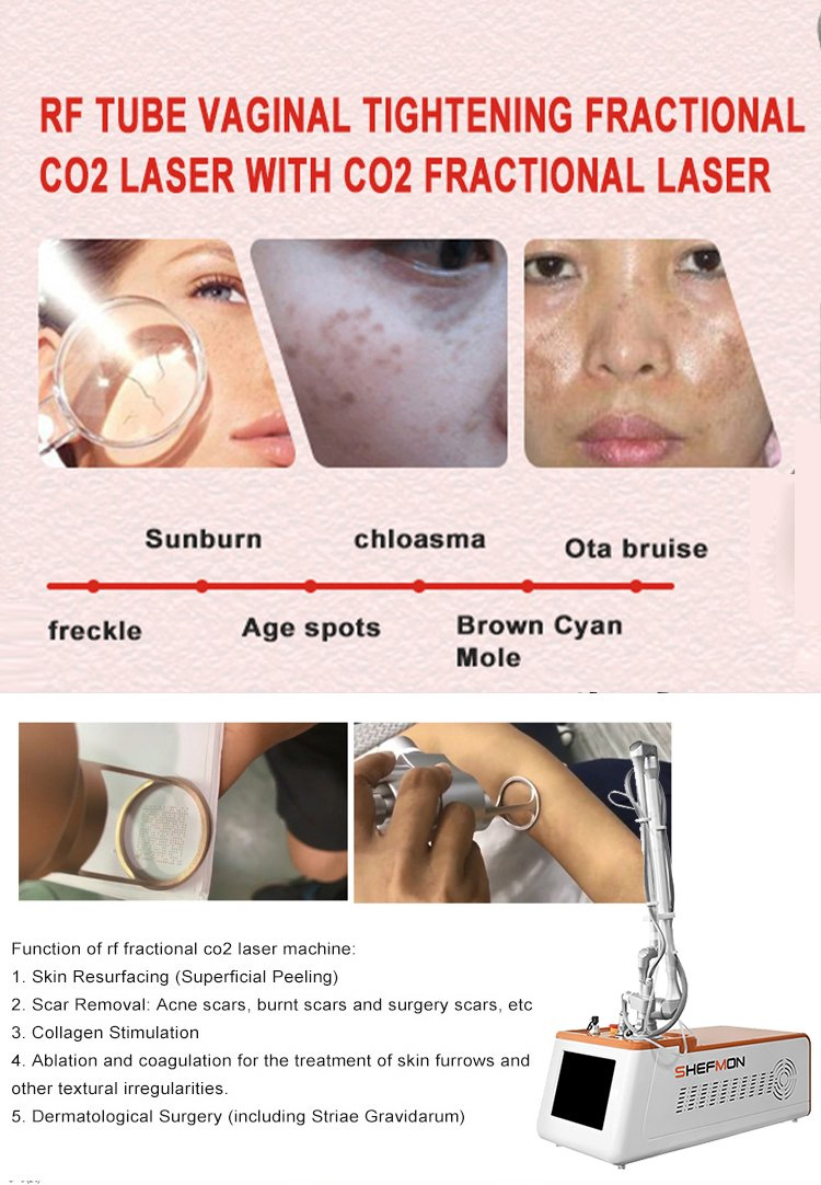2026 Newest Portable Fractional CO2 Laser Anti-Aging, Skin Tightening &amp; 360° Vaginal Rejuvenation Professional Beauty Device with Skin Rejuvenation