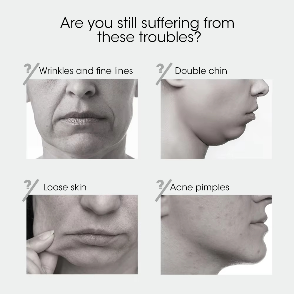 V Face Lifting Device Overview