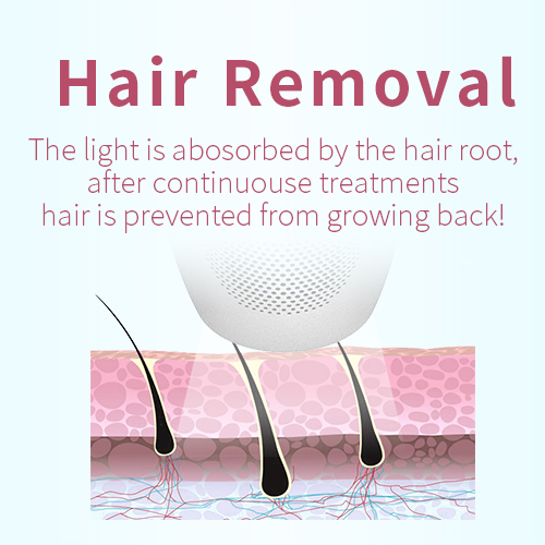DEESS GP591 3 in 1 Ipl Hair Laser Removal Device Painless Hair Remover Facial Hair Removal Device for Women