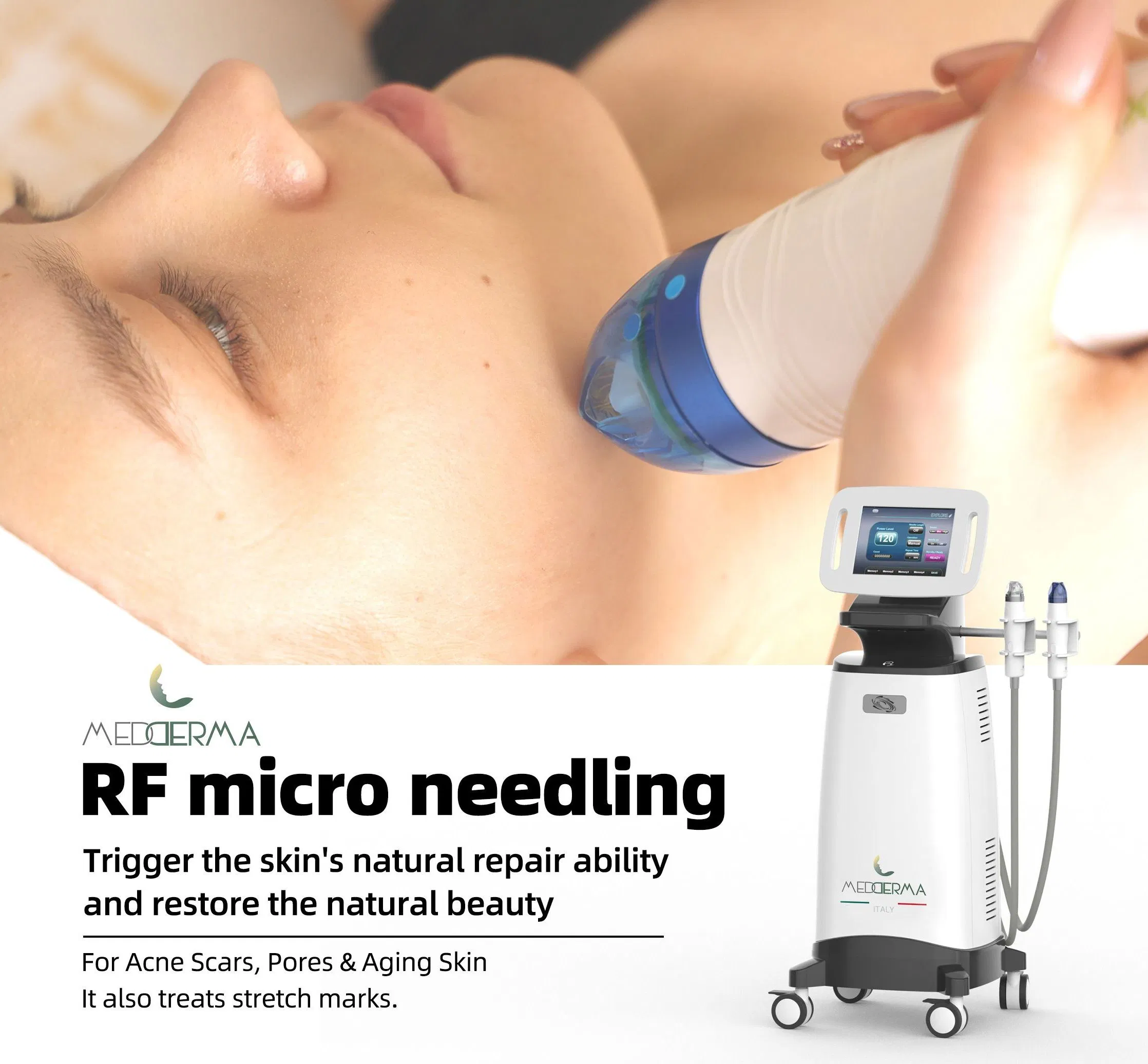 Advanced RF Skin Tightening Device for Acne and Firmness