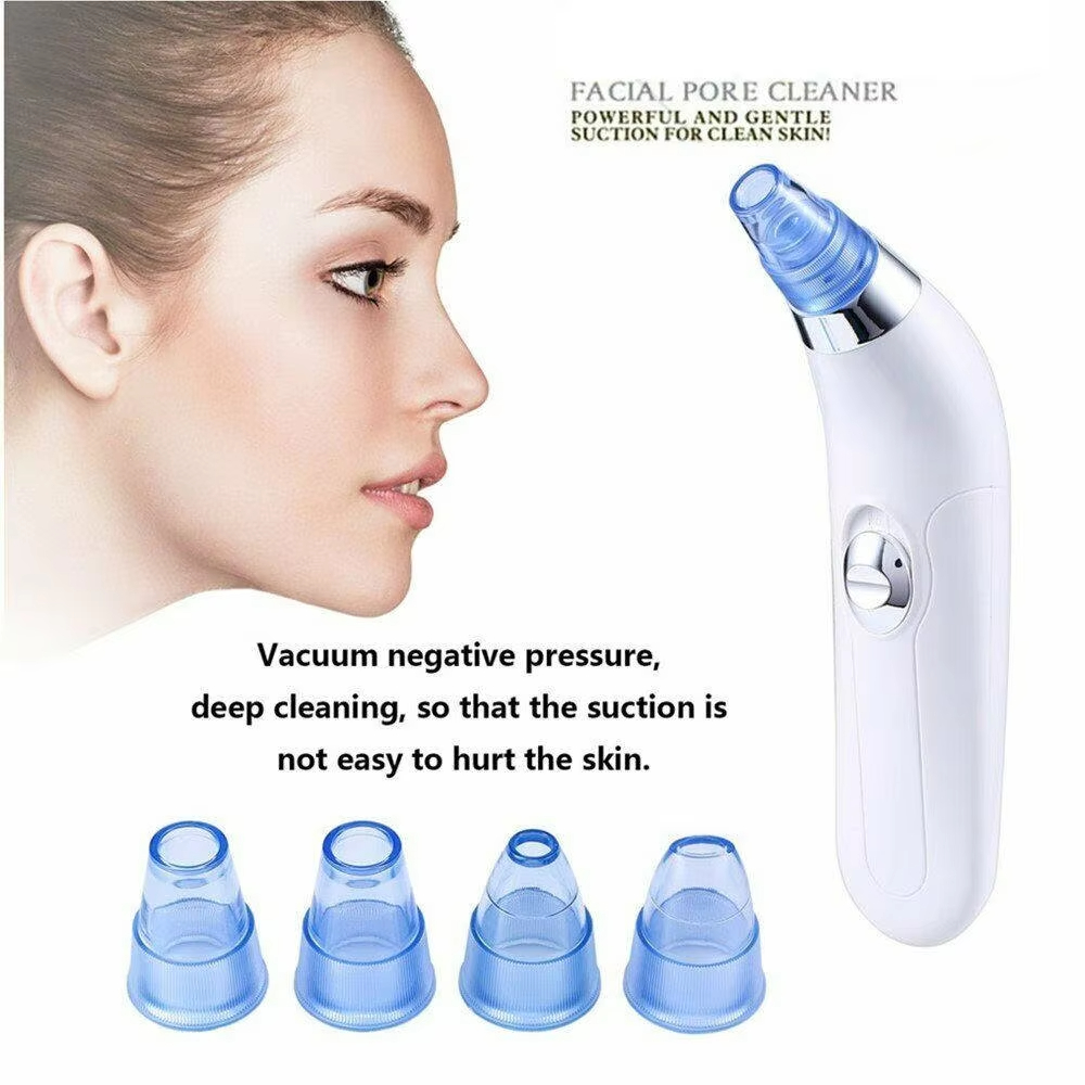 Vacuum Blackhead Remover Detail 8
