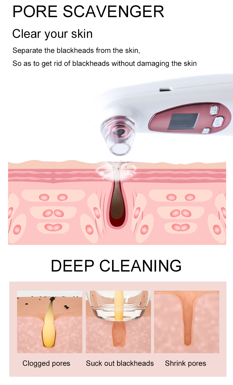 Blackhead Removal Tool