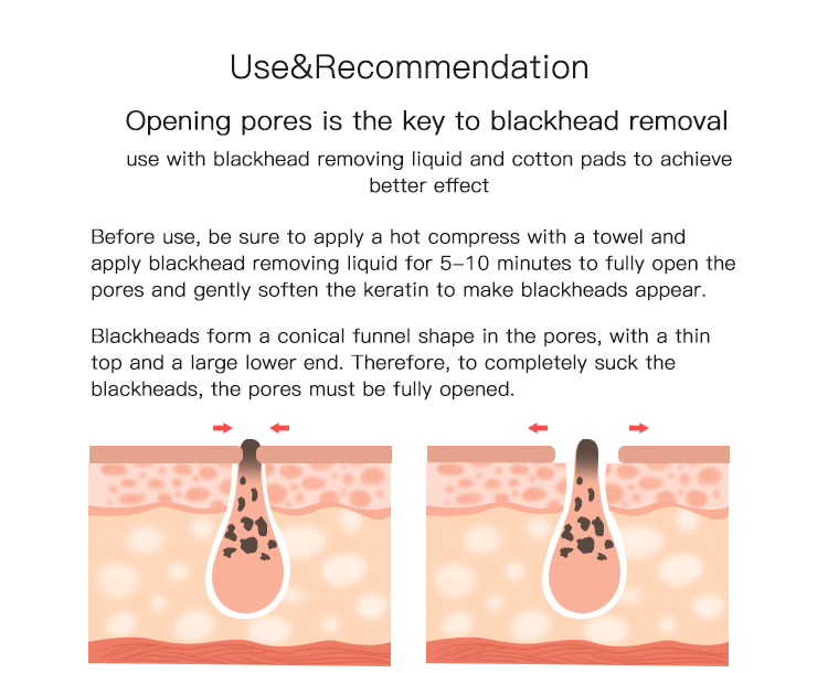 Popular Korean Vacuum Suction Blackhead Remover Pores Clean Tool Blackhead Acne Remove With Microdermabrasion For Nose Face