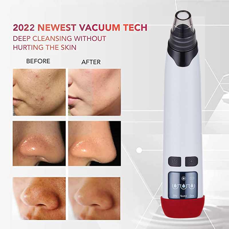 Low Price Private Label Pore Cleaner Blackhead Acne Treatment Vacuum Extractor Electronic Facial Whitehead &amp; Blackhead Remover