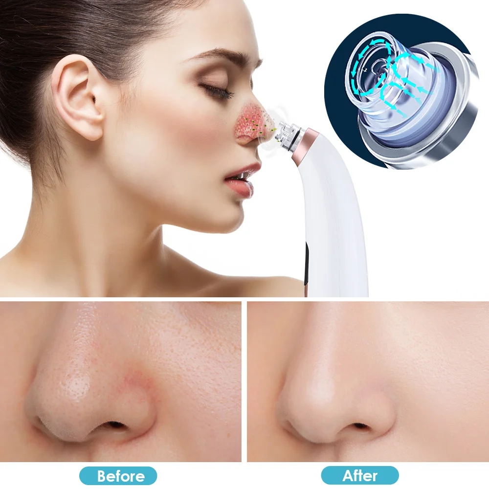 Removal Machine 2024 New Arrival Pore Vacuum Electric Cleaner Smaller Bubble With Blackhead Remover Skin Care Tools