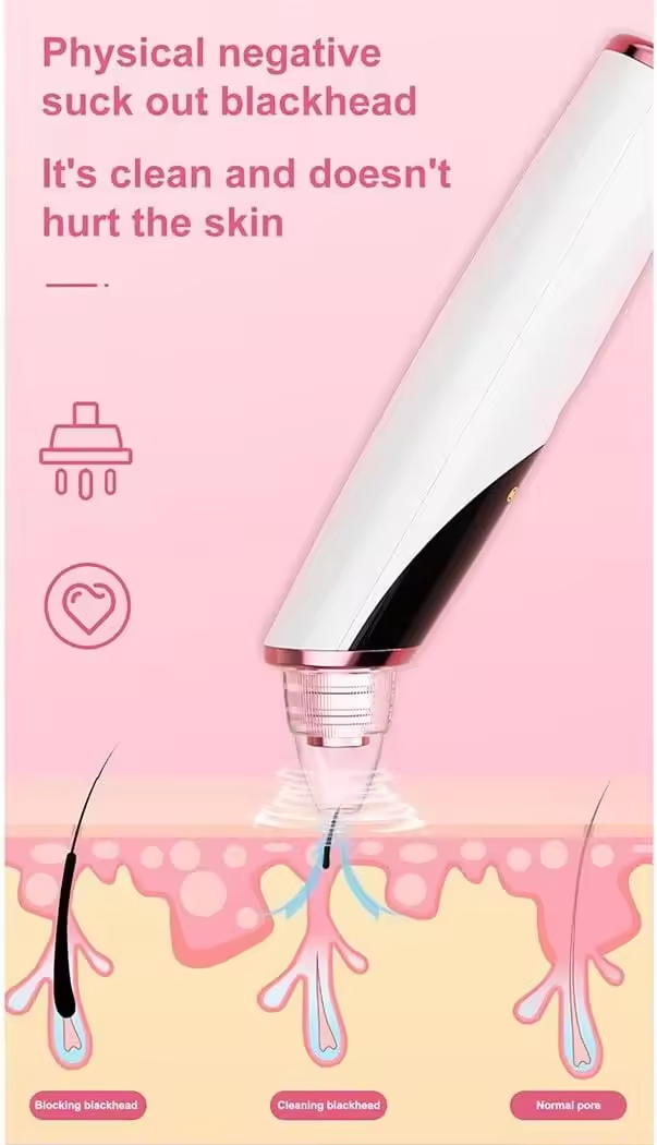 USB/Battery Dual-Drive Blackhead Remover - Vacuum Pore Cleaner Deep Facial Cleansing Home Portable Personal Care Appliance