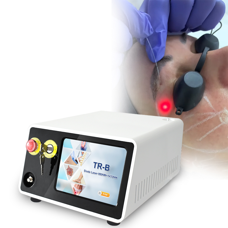 Endolaser 980nm 1470nm Skin Tightening Enfolift Medical Device
