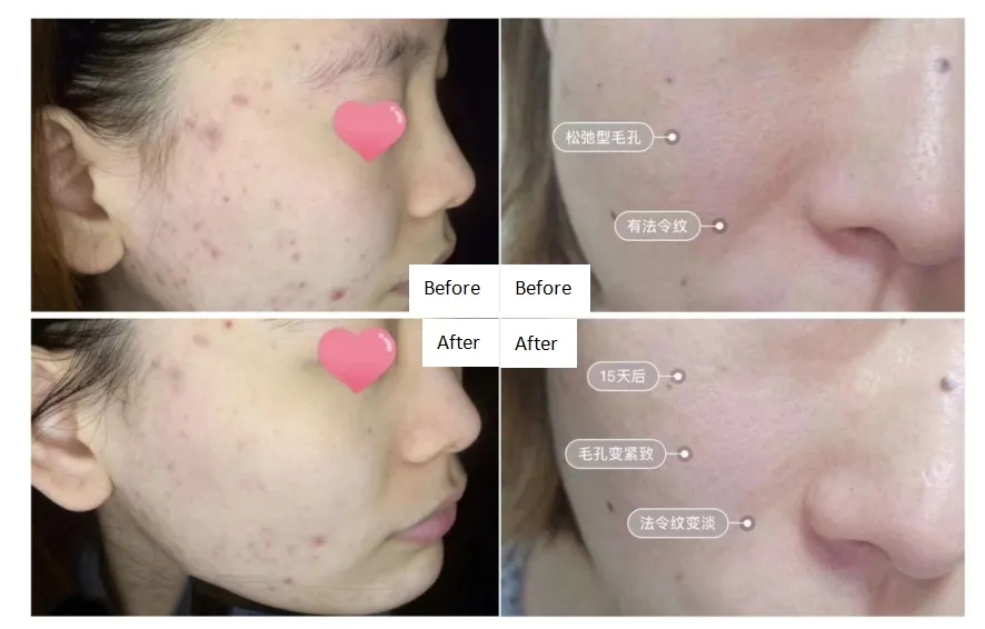 Before & After