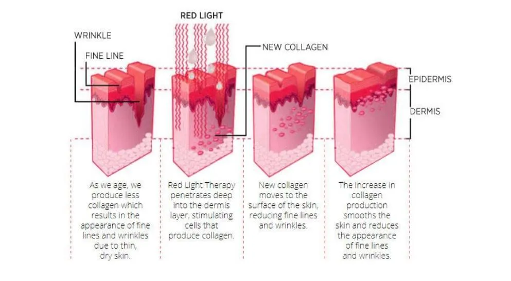 PDT Light Therapy Machine Function