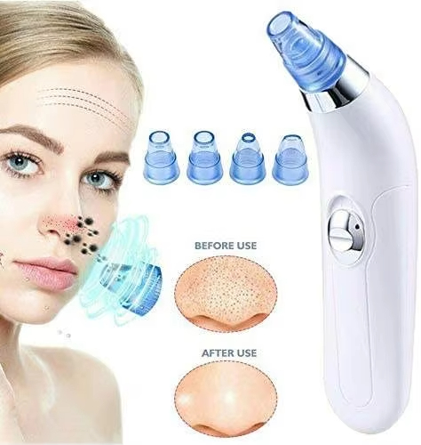 Vacuum Blackhead Remover Detail 4