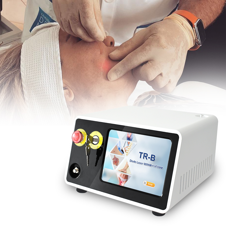 Endolaser 980nm 1470nm Skin Tightening Enfolift Medical Device