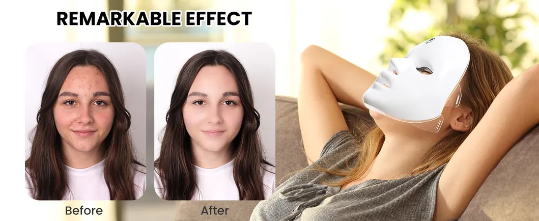 Therapy Effects 3