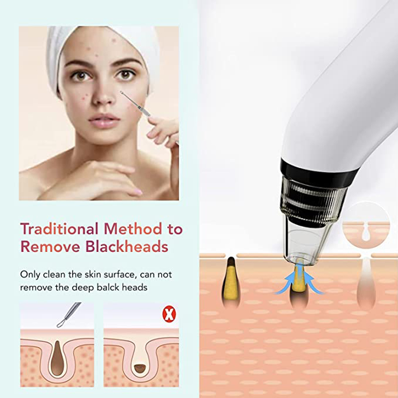 Low Price Private Label Pore Cleaner Blackhead Acne Treatment Vacuum Extractor Electronic Facial Whitehead &amp; Blackhead Remover