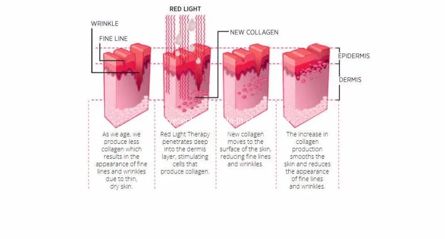 LED vs Laser Therapy