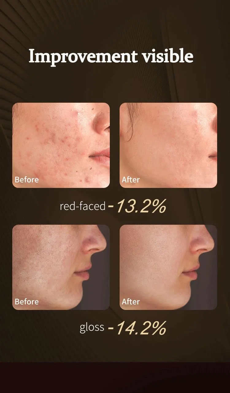 Beauty Mask 5