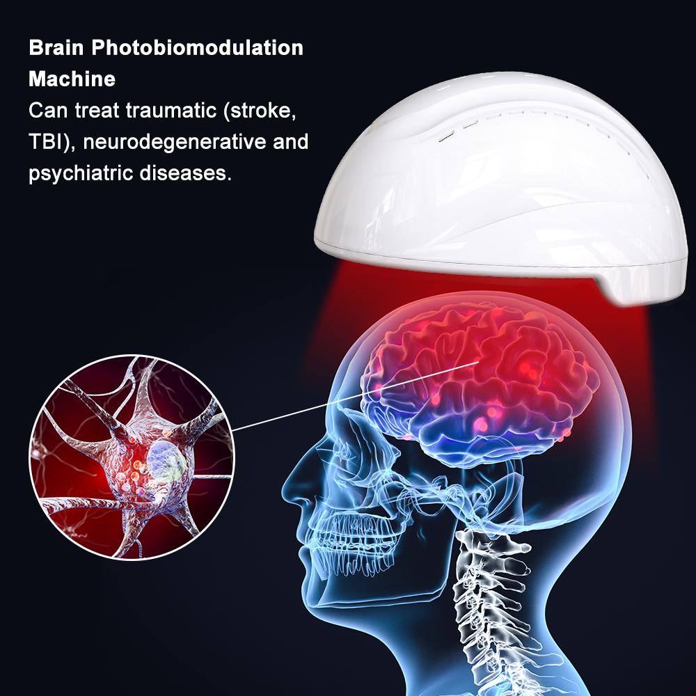 Suyzeko 288pcs 810nm Near Infrared LED Helmet PBM Photobiomodulation Brain Device For Memory Enhancement &amp; Cognitive Boost