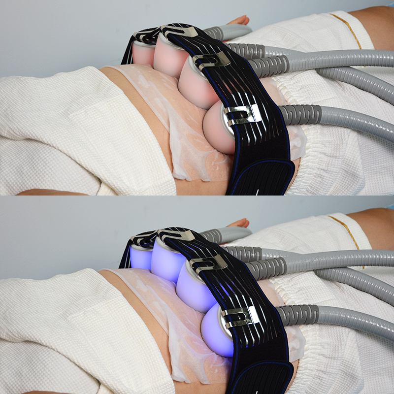 5 In 1 Beauty Machine Cryo Thermal Aesthetic Equipment Ice Face Body Facial Infrared Heating Sauna Blanket For Beauty Salon