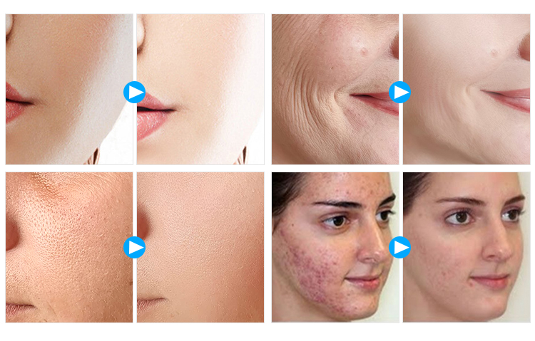 Before and After Results