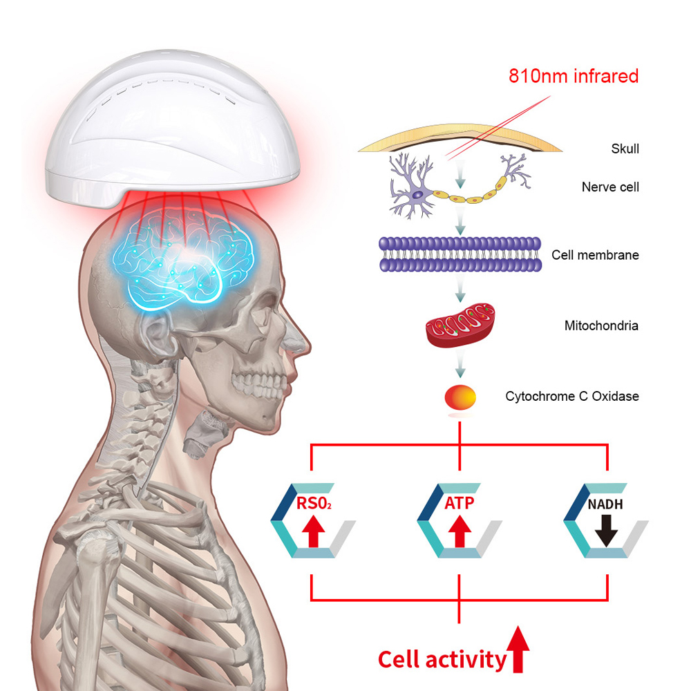 Suyzeko 288pcs 810nm Near Infrared LED Helmet PBM Photobiomodulation Brain Device For Memory Enhancement &amp; Cognitive Boost