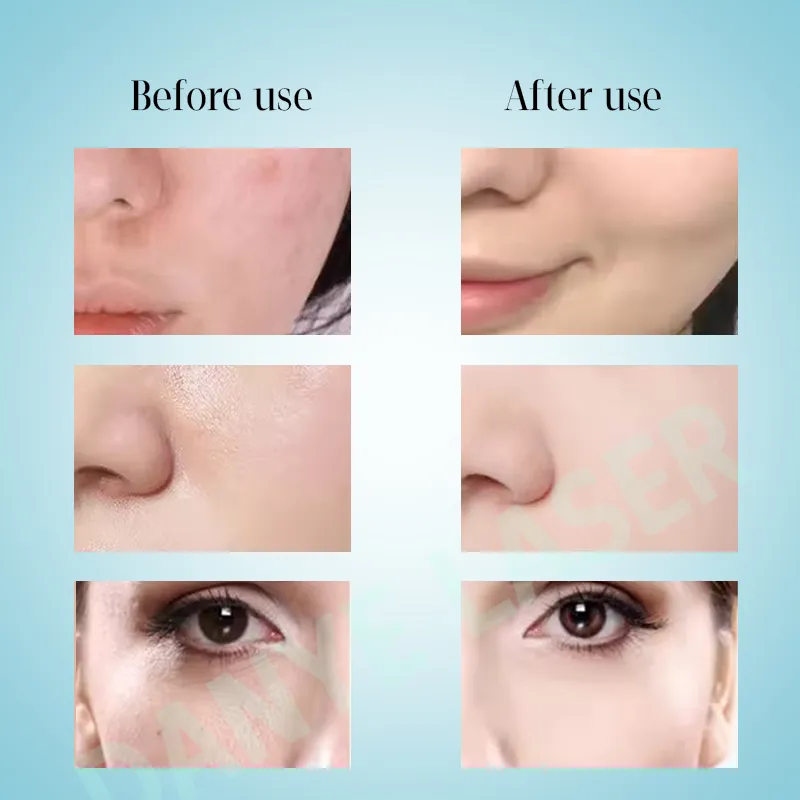 Before and After